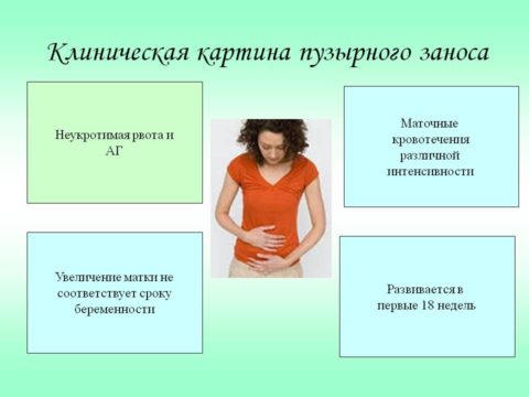 Пузырный занос – это одна из серьезных причин гипертиреоза при беременности. Пузырный занос – это одна из серьезных причин гипертиреоза при беременности.