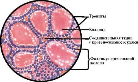 Фолликулы, проходя дистрофические изменения, могут переродится в кисты