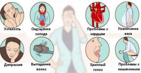 Основные признаки гипотиреоза при аутоиммунном воспалении