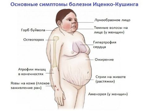 Проявления болезни Иценко-Кушинга Проявления болезни Иценко-Кушинга
