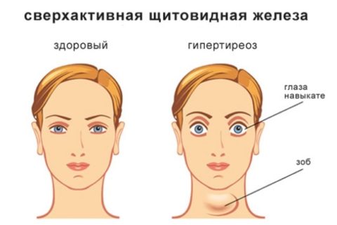 Специфические признаки ДТЗ