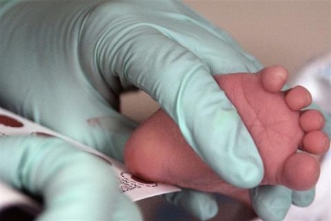 Проведение скрининга у малыша.