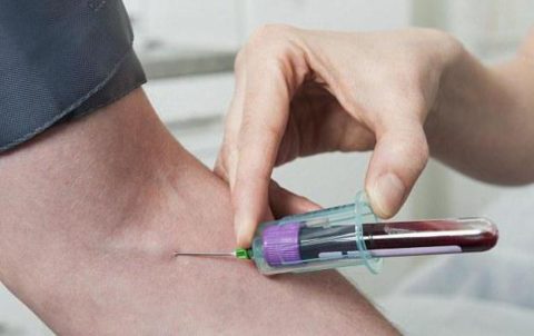 Техника забора венозной крови для ТТГ-исследования