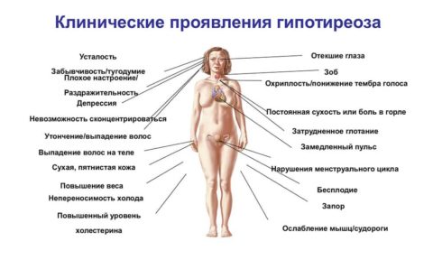 Признаки дисфункции щитовидной железы Признаки дисфункции щитовидной железы