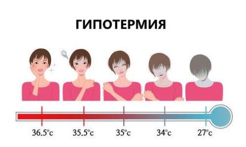 Гипотермия