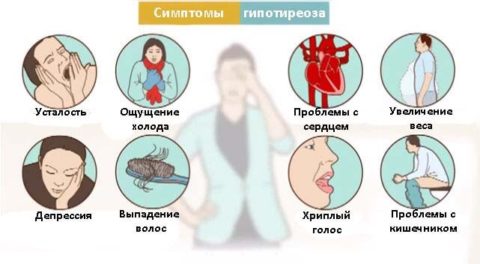 Гипотиреоз (падение синтетической активности ЩЖ)