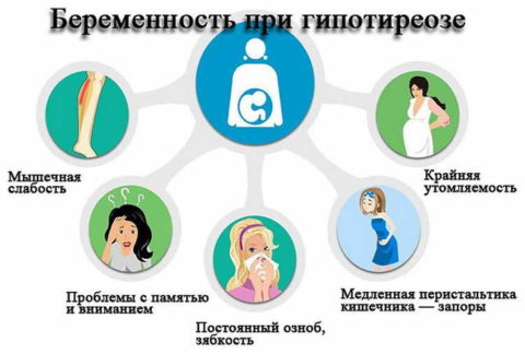 Признаки гипотиреоза